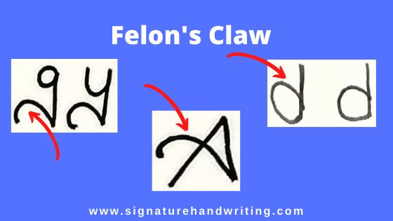 felon's-claw-in-handwriting-analysis